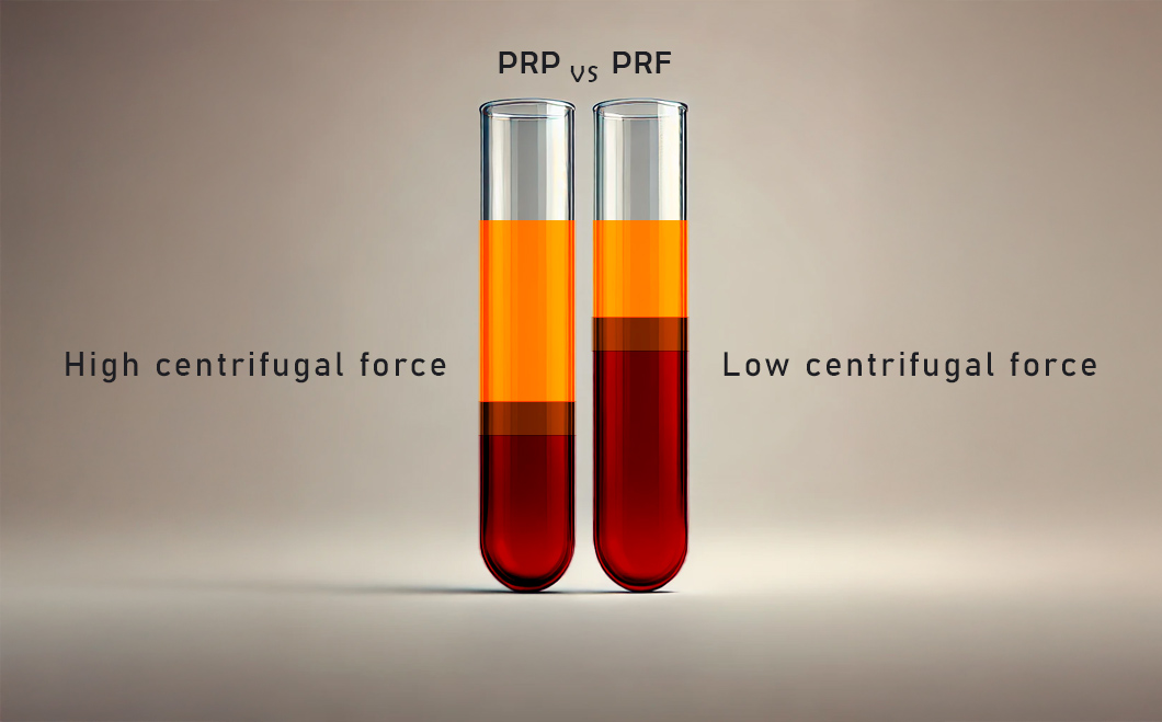 Compare PRP and PRF